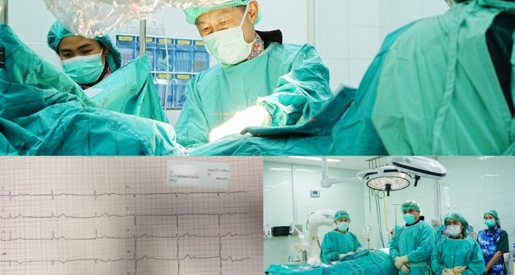 เคสที่ 5 ของโรงพยาบาลกุมภวาปี ผ่าตัดใส่เครื่องกระตุ้นการเต้นหัวใจ (Pacemaker)